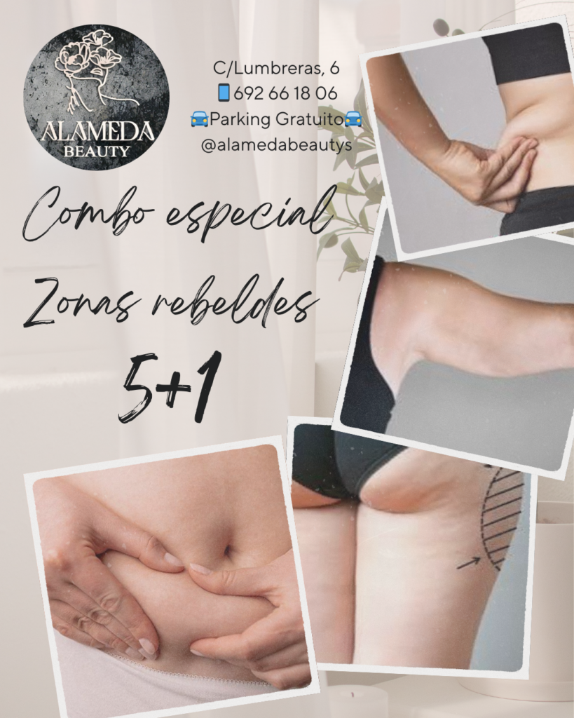 Combo especial zonas rebeldes