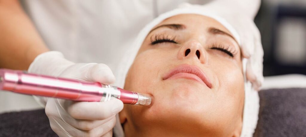 Dermapen-en-Sevilla-Clinica-especializada Dermapen-en-Sevilla-Clinica-especializada