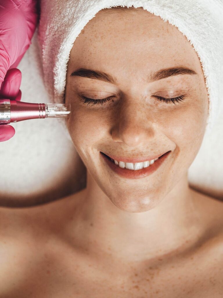 microneeding-en-Sevilla-Clinica-Estetica microneeding-en-Sevilla-Clinica-Estetica