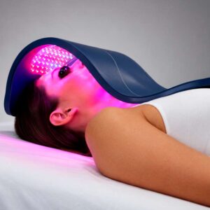 microneedlind-en-sevilla-con-celluma microneedlind-en-sevilla-con-celluma