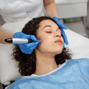 microneedling-en-Sevilla